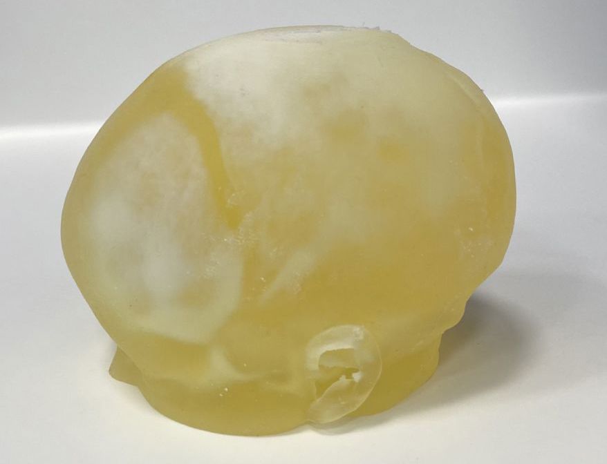 <div>Craniosynostosis Prototype Model created using Bone Matrix and&nbsp;<span style="letter-spacing: -0.03em;">Tissue Matrix Material - Side View.</span></div>