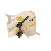 BoneMatrix  DAP 3d printed spine