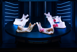 「3Dプリントは1000枚の画像に値する」：  J5 MediJetが南デンマーク大学病院（エスビエル）に、術前計画と研究を改善する新たな経路を提供