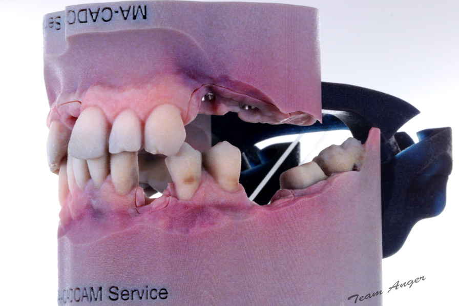dental model