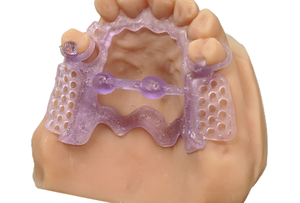 KeyCast® by Keystone Industries