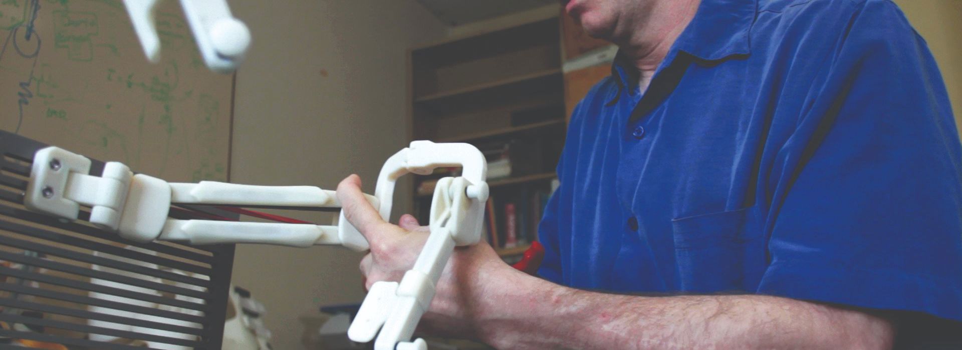 A custom 3D-printed version of the Wilmington Robotic Exoskeleton (WREX) empowers little Emma to use her arms despite arthrogryposis.