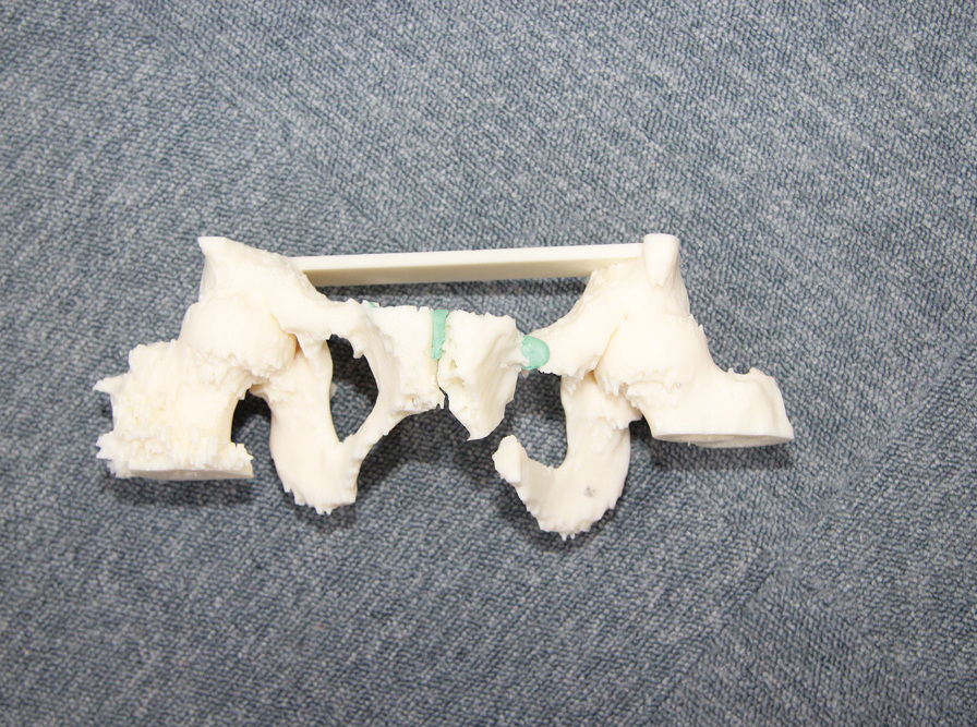 3d printed hip bones on grey background