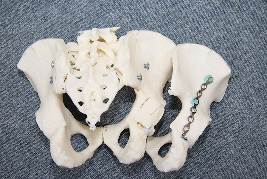 anterior view of 3d printed tailbone