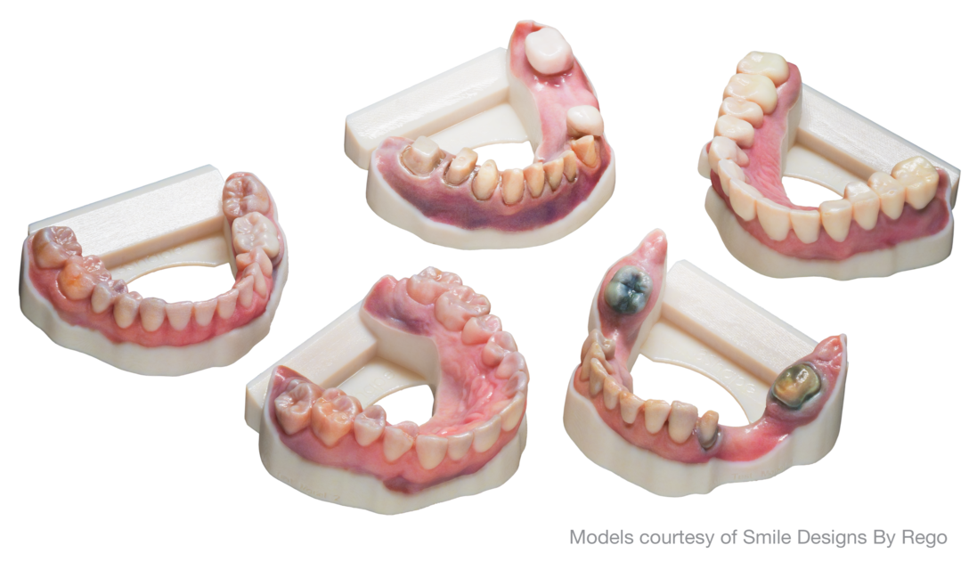 Dental models