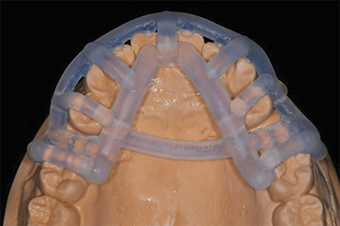 3D Printing Enhances Dental Surgeries