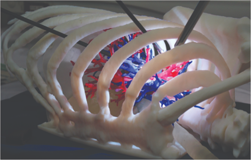 3D printed models allow surgeons to practice procedures
before performing them on human patients.