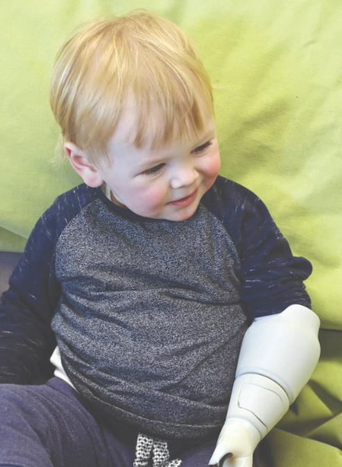 Child pictured with 3D printed arm. 