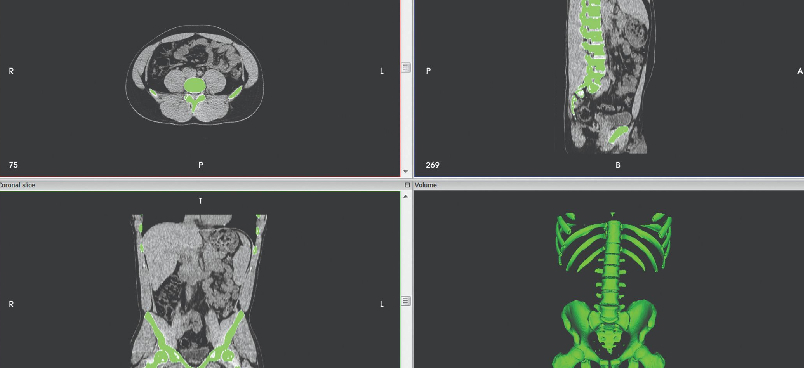 Data segmentation for medical 3D printing application guide
