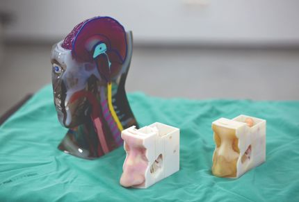 3D printed patient-specific models for surgical planning.