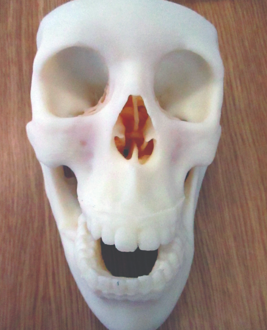 3D printed models help surgeons plan
treatment for facial and jaw operations.