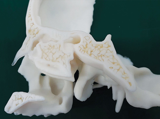 3d printed skull model