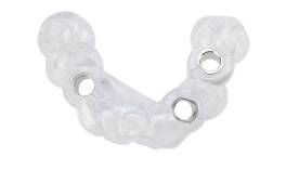 implant-surgical-guide