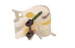 bone-matrix-3d-printing-material