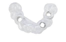 implant-surgical-guide