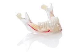 jaw-model-using-med620-verodent-purewhite-and-vero-vivid-magenta