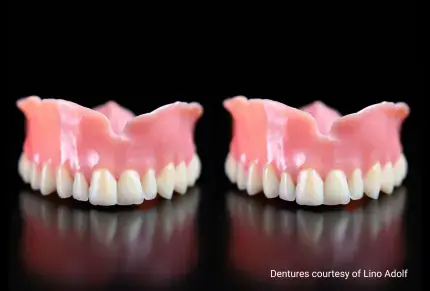 Stratasys TrueDent Denture Exact Duplicates