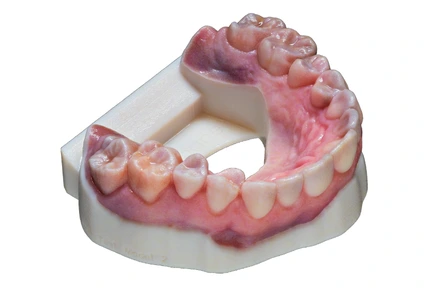 Stratasys 3D printed denture