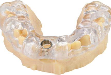 3D printed dental implant case by Stratasys