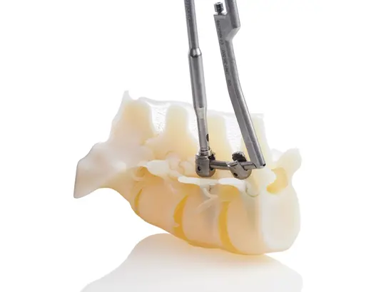 3d printed spine pedicle screw
