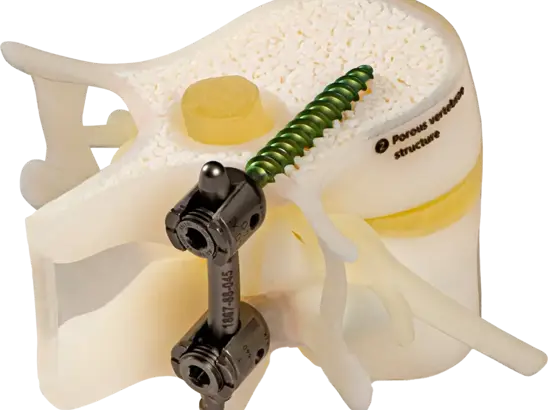 surgical drill inside brain