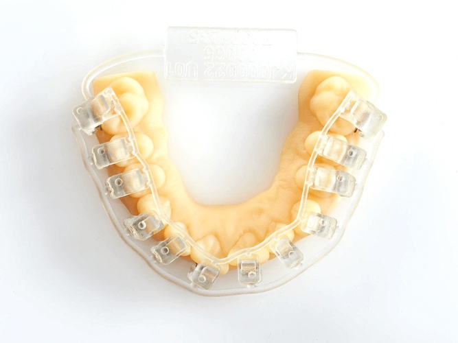 image gallery dental materials braces mq