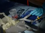 doctors-practicing-with-3d-printed-blood
