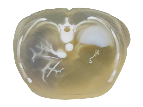 abdominal-stack-model