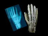 hand-3d-model-and-x-ray