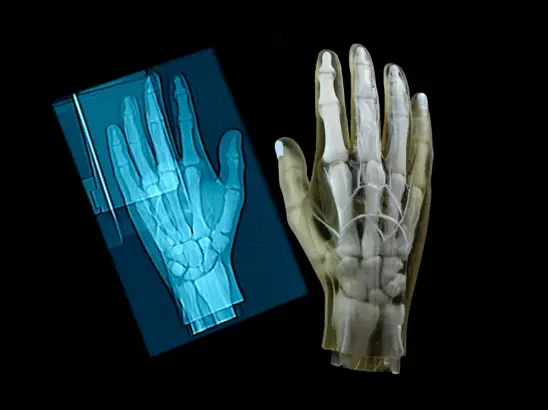hand-3d-model-and-x-ray