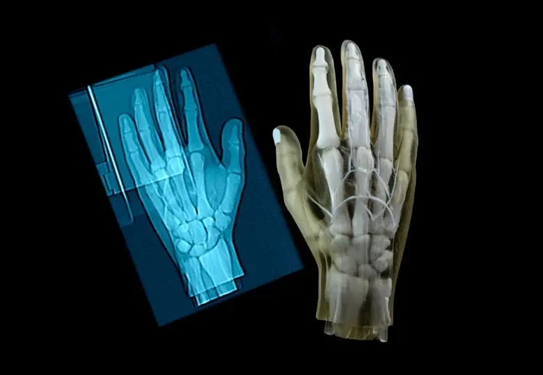 hand-3d-model-and-x-ray
