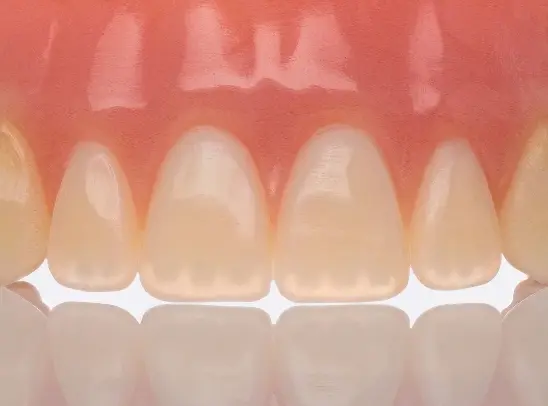 Stratasys TrueDent Denture closeup of internal structures.