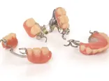 3D printed Stratasys TrueDent RPDs with metal frames.