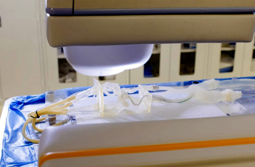 This 3D printed vascular testing model allows medical device designers and engineers to gather valuable performance feedback on device performance.