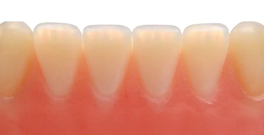 truedent-truevoxel-denture