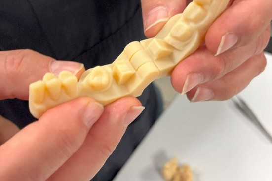 Dental Model 3D printed using Stratasys J5 DentaJet Series Printer