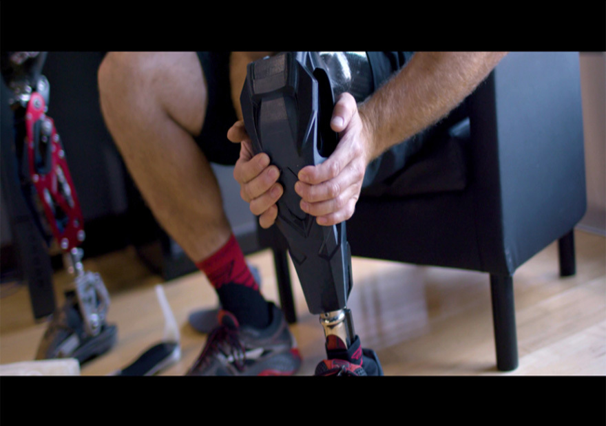 This prosthetic cover printed in TPU 92A on the F370 3D printer provides the benefits of a durable elastomer while serving as a functional part.