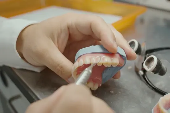 truedent-monolithic-one-piece-denture