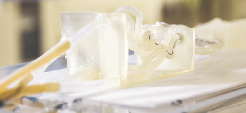 Preoperative Surgical Planning