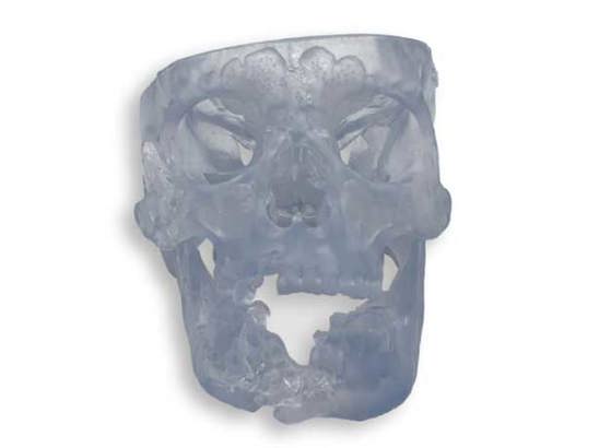 Stratasys Direct 3D Printed Anatomical Model in Somos BioClear Material